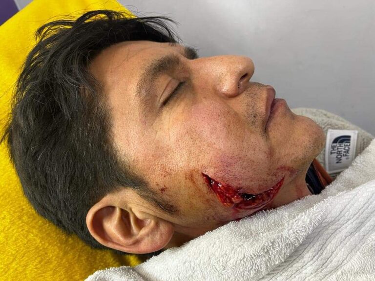 Uriel Moreno &lsquo;El Zapata&rsquo;, pris au visage sur la place péruvienne de Taraco