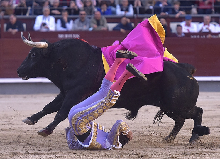 Ángel Téllez, fracture de l&rsquo;angle en spirale de l&rsquo;omoplate