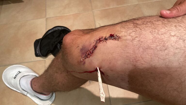 Dr Enrique Crespo: « Le geste héroïque de Fonseca, blessé, personne ne peut le lui expliquer »